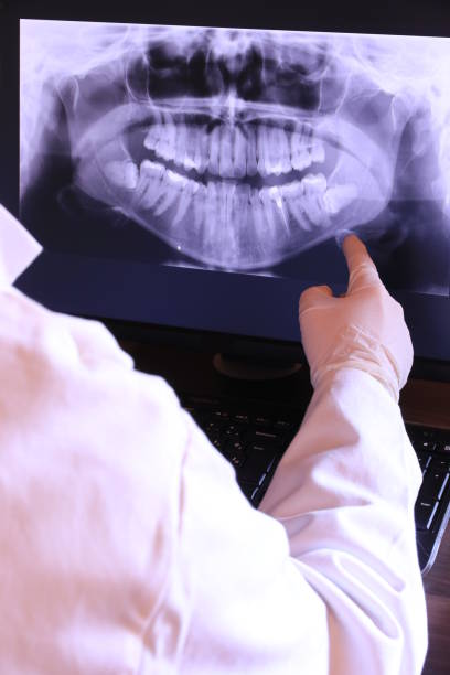 Best Emergency Root Canal Treatment in Martin, TN